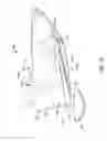 Fig. 20 - Anatomically customized ear canal hearing apparatus