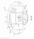 Fig. 22 - Anatomically customized ear canal hearing apparatus