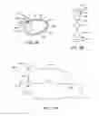 Fig. 25 - Anatomically customized ear canal hearing apparatus