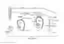 Fig. 22 - Hearing Assistance Systems Configured To Detect And Provide Protection To The User From Harmful Conditions