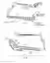 Fig. 47 - Hearing Assistance Systems Configured To Detect And Provide Protection To The User From Harmful Conditions