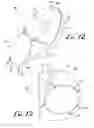 Fig. 07 - Infant support pillow