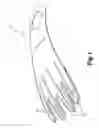 Fig. 02 - Device adapted to facilitate insertion of a hand into a glove