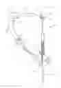 Fig. 01 - Anatomic femoral guide