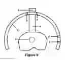 Fig. 06 - GUIDE DEVICE FOR INSERTION OF BLOCKING SCREWS USED TO ALIGN INSERTION OF INTRAMEDULLARY NAIL