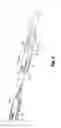 Fig. 05 - Electrosurgical forceps