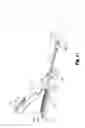 Fig. 12 - Electrosurgical forceps
