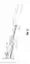 Fig. 13 - Electrosurgical forceps