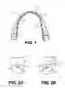 Fig. 02 - Bracket system and method for planning and producing a bracket system for the correction of tooth malpositions