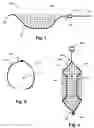 Fig. 02 - Vessel filter and methods for use