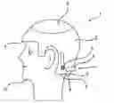Fig. 01 - Device for Cooling Scalp