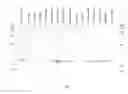 Fig. 07 - Beta-lactamases with improved properties for therapy
