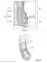Fig. 03 - System and method for electrical stimulation of anorectal structures to treat urinary dysfunction