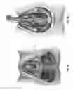 Fig. 05 - System and method for electrical stimulation of anorectal structures to treat urinary dysfunction