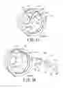 Fig. 13 - Chain tensioning device