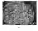 Fig. 04 - Particles of N-(5-cyano-4-((2-methoxyethyl)amino)pyridin-2-yl)-7-formyl-6-((4-methyl-2-oxopiperazin-1-yl)methyl)-3,4-dihydro-1,8-naphthyridine-1(2H)-carboxamide