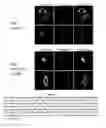 Fig. 05 - Compounds, compositions and methods for inhibiting CNKSR1