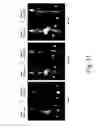Fig. 32 - Compound for bone scanning and use thereof