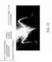 Fig. 33 - Compound for bone scanning and use thereof