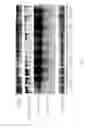 Fig. 03 - Method for preventing or treating heart diseases by using a composition containing an isolated peptide