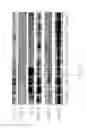 Fig. 14 - Method for preventing or treating heart diseases by using a composition containing an isolated peptide
