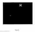 Fig. 09 - Cationic lipid formulations for regressing established tumor