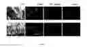 Fig. 17 - Cationic lipid formulations for regressing established tumor