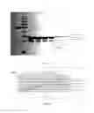 Fig. 03 - SpA5 mutant, composition comprising mutant and preparation method and use thereof