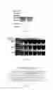 Fig. 06 - SpA5 mutant, composition comprising mutant and preparation method and use thereof