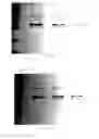 Fig. 23 - SpA5 mutant, composition comprising mutant and preparation method and use thereof