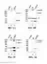 Fig. 04 - Methods and compositions for the display of polypeptides on the pili of Gram-positive bacteria