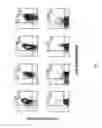 Fig. 02 - CD38 as a prognostic indicator in B cell chronic lymphocytic leukemia