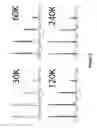 Fig. 03 - Neutron encoded mass tags for analyte quantification