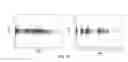 Fig. 33 - Population pharmacokinetics tools and uses thereof