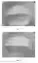Fig. 02 - Method to lighten the texture of a fermented dairy product