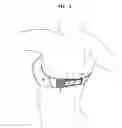 Fig. 04 - All of me strapless bra