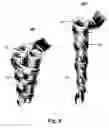 Fig. 08 - Hair roller