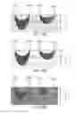 Fig. 24 - System and Method for Mitigating the Effects of Tissue Blood Volume Changes to Aid in Diagnosing Infiltration or Extravasation in Animalia Tissue