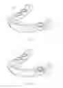 Fig. 02 - Positioning and installing surgical drilling devices and related devices and systems