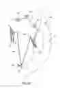 Fig. 09 - Methods of delivering and deploying a heart valve apparatus at a mitral valve