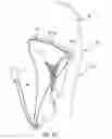 Fig. 49 - Methods of delivering and deploying a heart valve apparatus at a mitral valve