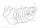 Fig. 01 - Orthopedic toe guard