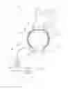Fig. 01 - Artificial ventricles