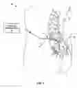 Fig. 02 - Cannula configured to deliver test stimulation