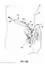 Fig. 13 - Cannula configured to deliver test stimulation
