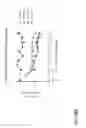 Fig. 70 - METHODS OF TREATING PATIENTS HAVING MUTATIONS IN THE EXTRACELLULAR DOMAIN OF EPIDERMAL GROWTH FACTOR RECEPTOR (EGFR) WITH A COMBINATION OF THREE FULLY HUMAN MONOCLONAL ANTI-EGFR ANTIBODIES