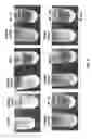 Fig. 03 - Passive immunization for infections