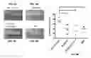 Fig. 05 - Passive immunization for infections