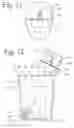 Fig. 08 - Portable air treatment system