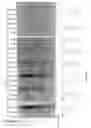 Fig. 07 - Targeting emopamil binding protein (EBP) with small molecules that induce an abnormal feedback response by lowering endogenous cholesterol biosynthesis
